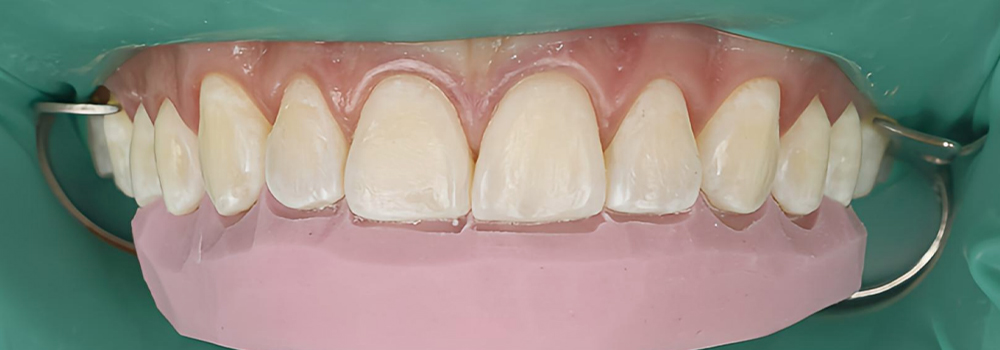 diseño de bordes2 antes