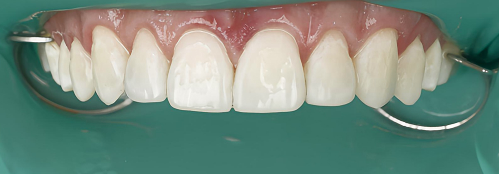 diseño de bordes2 despues