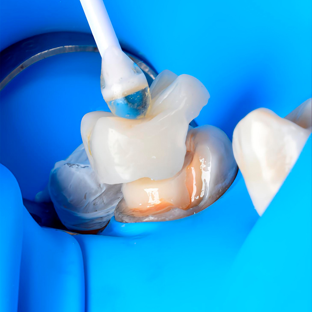 Absolute Isolation Technique and its Importance - Dr. Alejandro Martinez